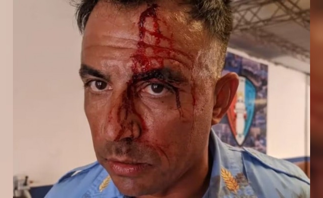 Policías fueron atacados a palazos por una mujer