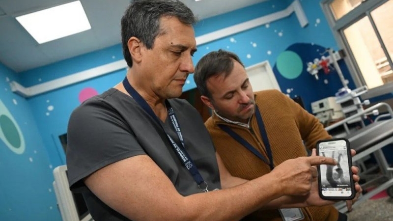 El Hospital de Ni&ntilde;os volvi&oacute; a hacer historia: se coloc&oacute; el primer stent completamente bioabsorbible en coartaci&oacute;n de aorta en el pa&iacute;s