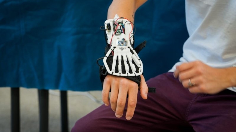 Estudiantes cordobeses crearon una mano rob&oacute;tica para rehabilitaci&oacute;n